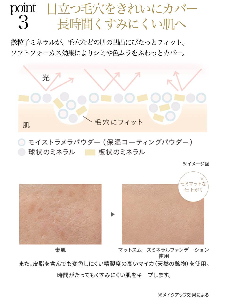 ETVOSアンケート