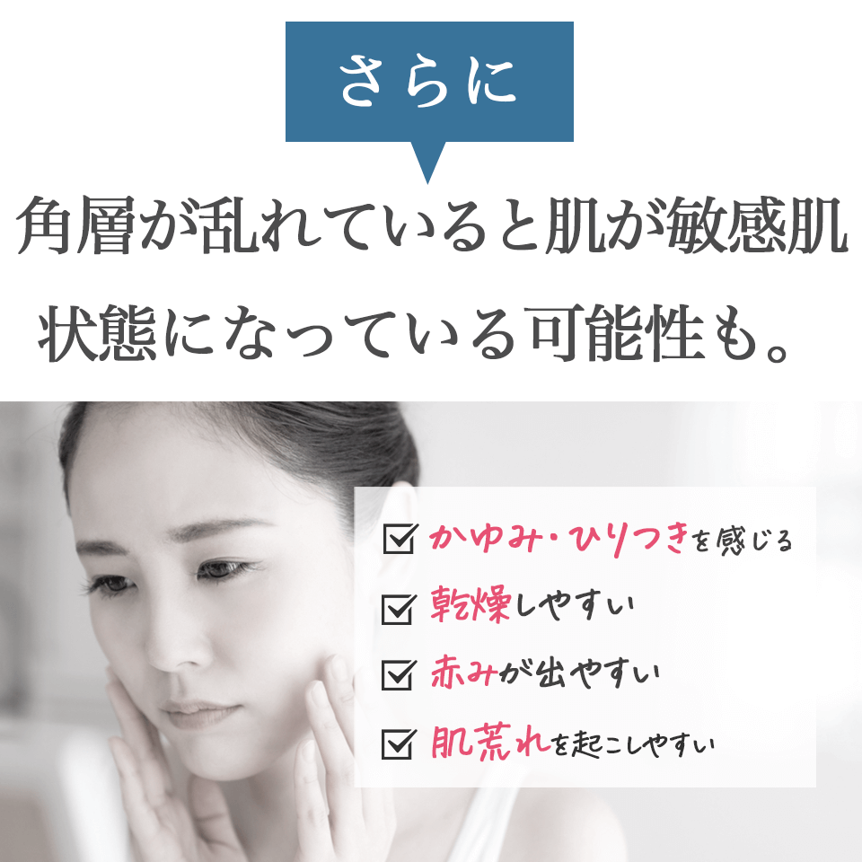 ディセンシアFL