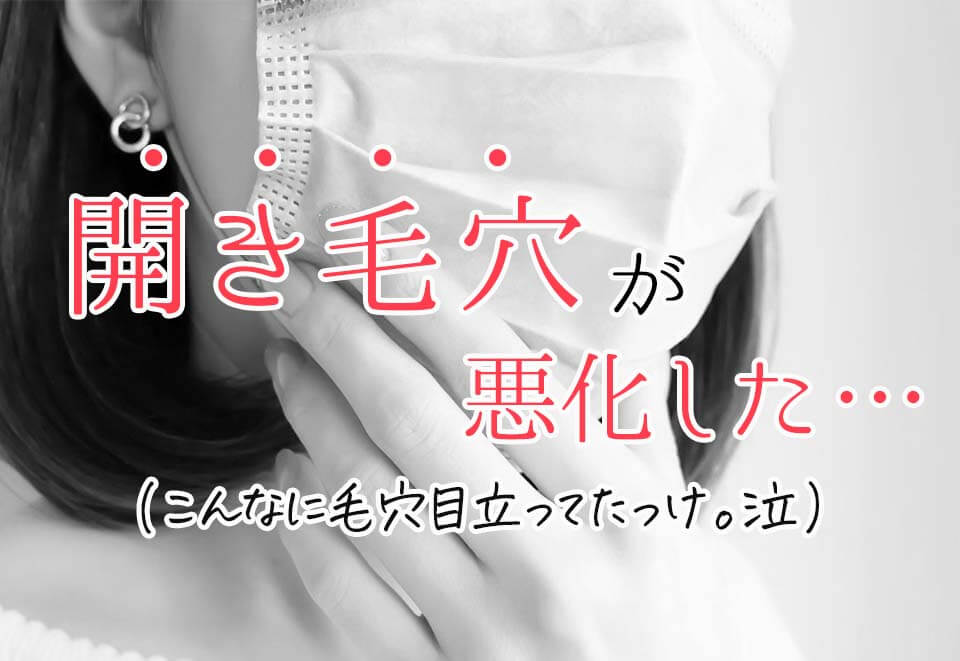 米肌レビュー記事