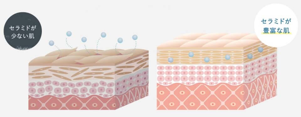 米肌レビュー記事