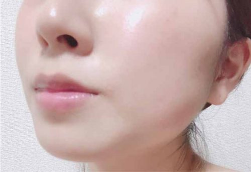 ブライトエイジ　口コミ①